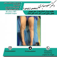 #ارتوپد #جراحی_ارتوپد #مفصل_زانو #جراحیارتوپد #مفصل_لگن#جراحی_زانو #جراحی_لگن #جراحیزانو #ارتوپدی