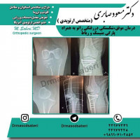 #ارتوپد #جراحی_ارتوپد #مفصل_زانو #جراحیارتوپد #مفصل_لگن#جراحی_زانو #جراحی_لگن #جراحیزانو #ارتوپدی