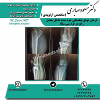 #ارتوپد #جراحی_ارتوپد #مفصل_زانو #جراحیارتوپد #مفصل_لگن#جراحی_زانو #جراحی_لگن #جراحیزانو #ارتوپدی