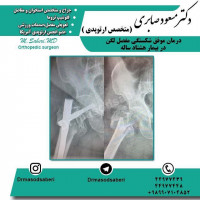 #ارتوپد #جراحی_ارتوپد #مفصل_زانو #جراحیارتوپد #مفصل_لگن#جراحی_زانو #جراحی_لگن #جراحیزانو #ارتوپدی