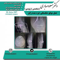 #ارتوپد #جراحی_ارتوپد #مفصل_زانو #جراحیارتوپد #مفصل_لگن#جراحی_زانو #جراحی_لگن #جراحیزانو #ارتوپدی