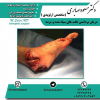 #ارتوپد #جراحی_ارتوپد #مفصل_زانو #جراحیارتوپد #مفصل_لگن#جراحی_زانو #جراحی_لگن #جراحیزانو #ارتوپدی