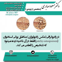 #ارتوپد#جراحی_ارتوپد#مفصل_زانو#مفصل_لگن#جراحی_زانو#جراحی_لگن#