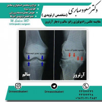 #ارتوپد#جراحی_ارتوپد#مفصل_زانو#مفصل_لگن#جراحی_زانو#جراحی_لگن#