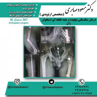 درمان شکستگی پیچیدہ و چند قطعہ ای استخوان ران با یک عمل
https://t.me/drmasodsaberi
https://www.instagram.com/drmasodsaberi/

#ارتوپد#جراحی_ارتوپد#مفصل_زانو#مفصل_لگن#جراحی_زانو#جراحی_لگن#