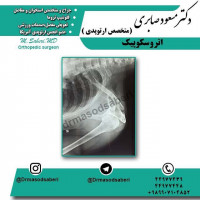 درمان بستہ(اتروسکوپیک )در رفتگی حاد قدامی شانہ در فرد ورزشکار

#ارتوپد#جراحی_ارتوپد#مفصل_زانو#مفصل_لگن#جراحی_زانو#جراحی_لگن#
