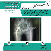 #ارتوپد#جراحی_ارتوپد#مفصل_زانو#مفصل_لگن#جراحی_زانو#جراحی_لگن#