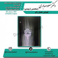 #ارتوپد#جراحی_ارتوپد#مفصل_زانو#مفصل_لگن#جراحی_زانو#جراحی_لگن#