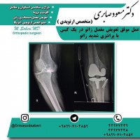 #ارتوپد#جراحی_ارتوپد#مفصل_زانو#مفصل_لگن#جراحی_زانو#جراحی_لگن#