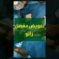 ↕تعویض مفصل زانو به چه معناست؟
تعویض مفصل زانو یعنی جایگزینی سطوح مفصل دو استخوان ران و ساق با پروتز مخصوص
.
.
#تعویض_مفصل_زانو #متخصص_ارتوپدی #دکترمسعودصابری