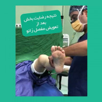 ↕نتیجه رضایت بخش بعد از تعویض مفصل زانو توسط دکتر مسعود صابری
.
.
#زانو #تعویض_مفصل_زانو #مفصل_زانو #تعویضمفصلزانو #مفصلزانو #عمل_مفصل_زانو #عمل_تعویض_مفصل_زانو
#متخصص_ارتوپدی #ارتوپد #ارتوپدی #دکتر_مسعودصابری #دکترصابری