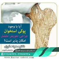 .
پوکی استخوان نوعی بیماری محسوب می شود که طی آن استخوان ها بسیار ضعیف و شکننده می شوند و احتمال بروز شکستگی در آنها افزایش پیدا می کند.
.
 افراد مسن حتی با وجود داشتن عارضه پوکی استخوان نیز می توانند جراحی تعویض مفصل مصنوعی انجام دهند.
.
البته این موضوع بسیار طبیعی است که استخوان های ضعیف همیشه مستعد شکستگی می باشد، چه در حین عمل چه بعد از جراحی. .وجود یک مفصل مصنوعی در استخوان ران موجب می شود درمان شکستگی این استخوان پیچیده تر و مشکل تر شود. .
گاهی این شکستگی موجب لق شدن مفصل مصنوعی ران می شود. در این شرایط همراه با جا اندازی و فیکس کردن شکستگی مفصل لق شده را هم تعویض کرد.

#پوکی_استخوان #پوکی_استخوان_و_ساییدگی_مفاصل  #تعویض_مفصل #ساییدگی_زانو #دکتر_مسععود_صابری